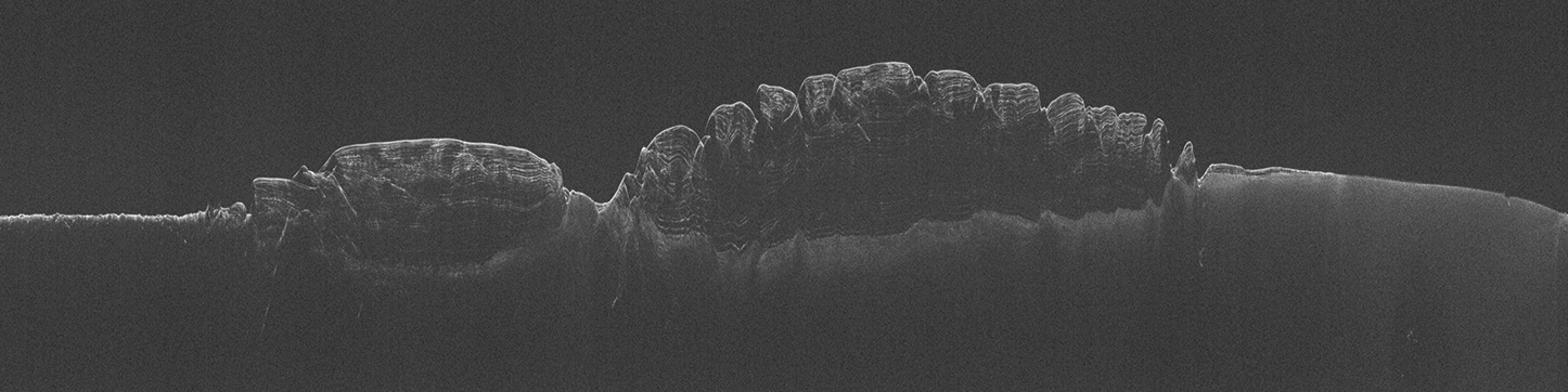 Example SHARAD radargram of Mars' North Polar Layered Deposits